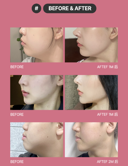 텍스트, 인간의얼굴, 피부, 스크린샷이(가) 표시된사진AI 생성콘텐츠는정확하지않을수있습니다.