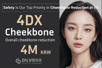 4DX cheekbone reduction product image