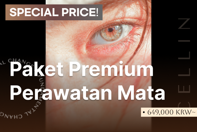 Paket Premium Perawatan Mata product image