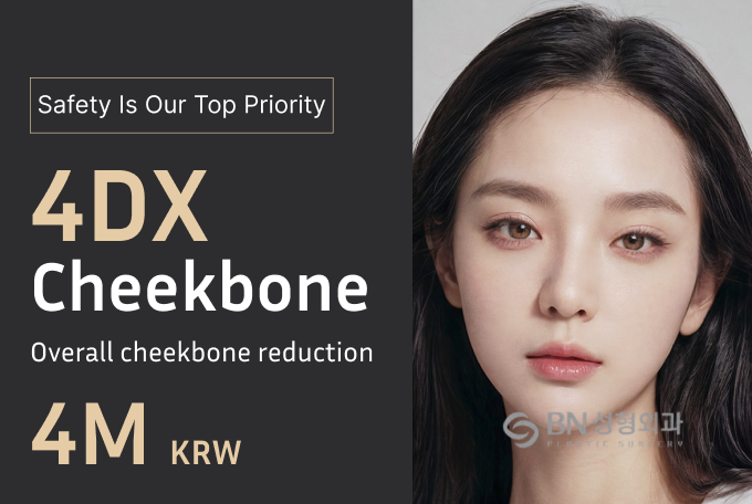4DX Cheekbone Reduction Surgery product image