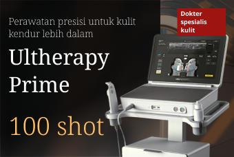 Timeless Ultherapy Prime product image