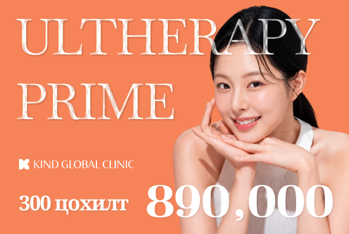 Ultherapy Prime 300 шот product image