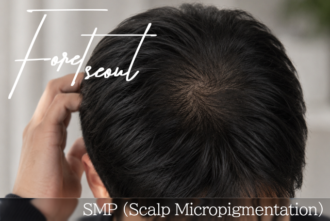 SMP (Scalp Micropigmentation) product image