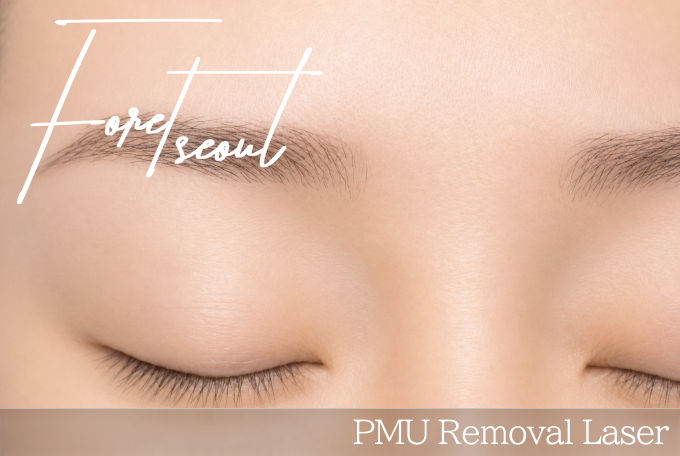 PMU Removal Laser product image