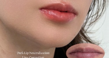 Neutralizing purple dark lips, adding a natural flush to dull-looking lips 🤍
