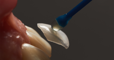 What Is ZERONATE? A Complete Guide for International Patients