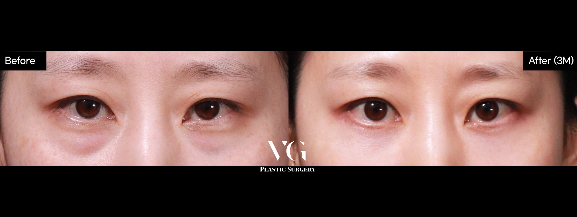 Klinik Bedah Plastik Very Good