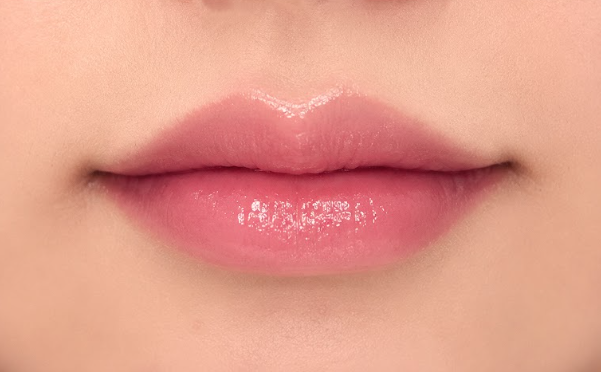 Lip Filler Before & After