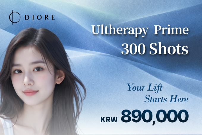 Ultherapy Prime 300shots product image